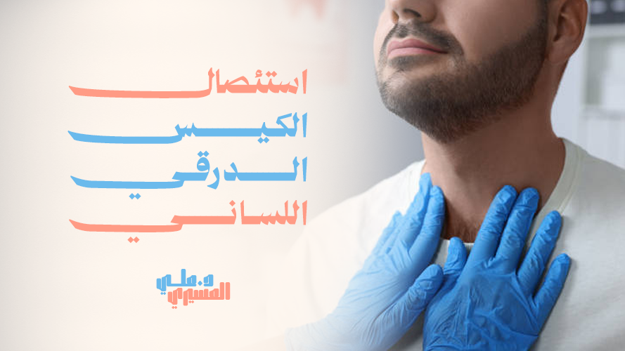 استئصال الكيس الدرقي اللساني | علاج فعال بأيدٍ خبيرة