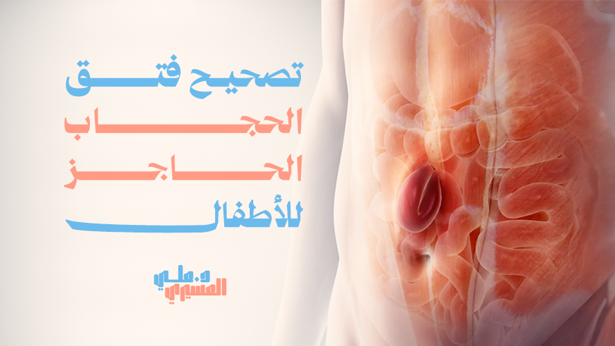 تصحيح فتق الحجاب الحاجز للأطفال, علاج آمن وفعال لمستقبل أفضل