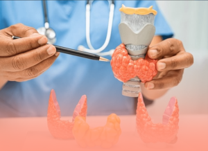 جراحات الغدد