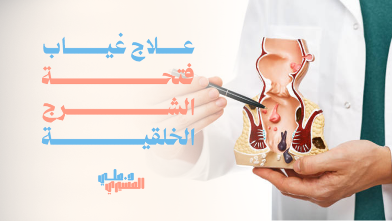 علاج غياب فتحة الشرج الخلقية