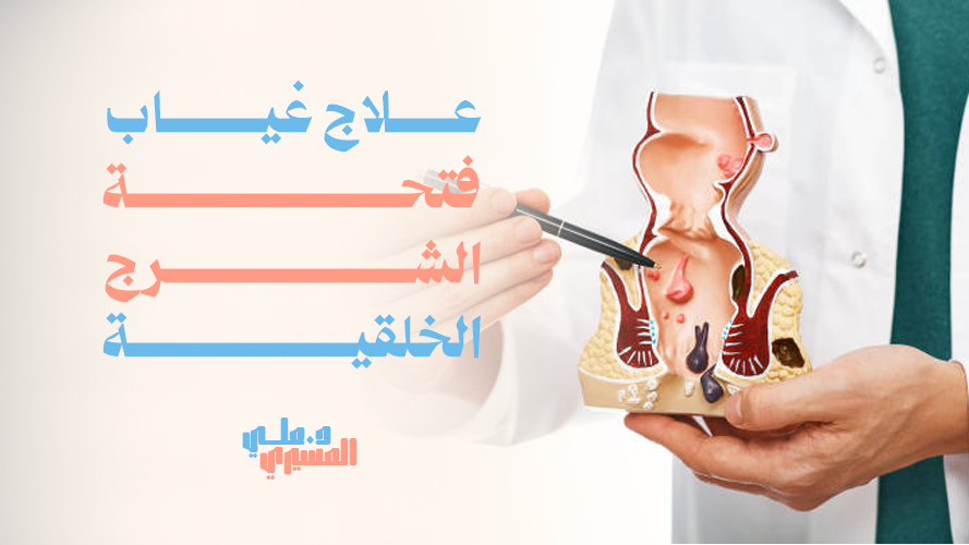 علاج غياب فتحة الشرج الخلقية, حلول طبية مبتكرة للأطفال