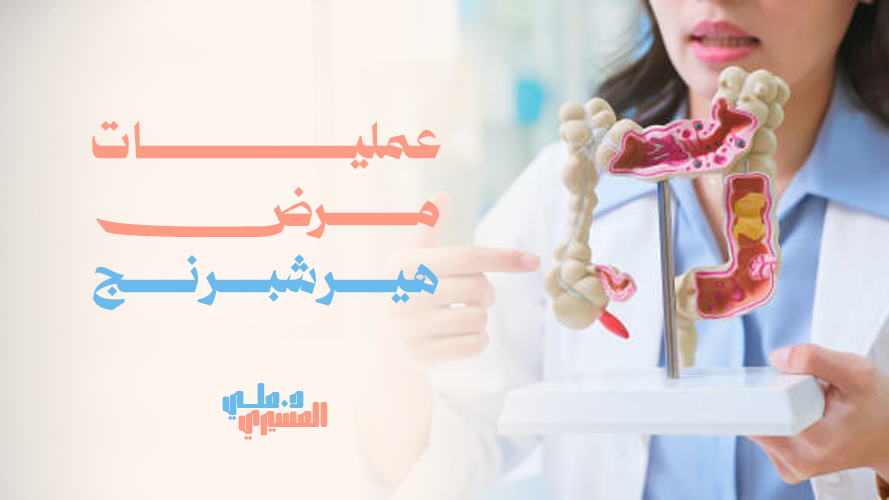 عمليات مرض هيرشبرنج, العلاج الجراحي الأفضل لتحسين صحة الأمعاء