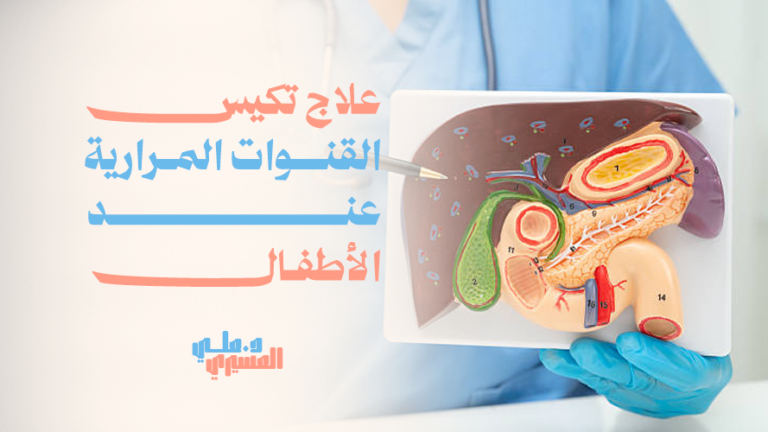 علاج تكيس القنوات المرارية عند الأطفال