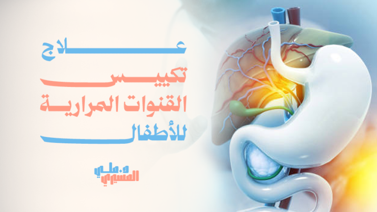 علاج تكييس القنوات المرارية للأطفال