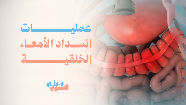 عمليات انسداد الأمعاء الخلقية