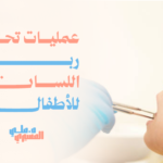 عمليات تحرير ربط اللسان للأطفال