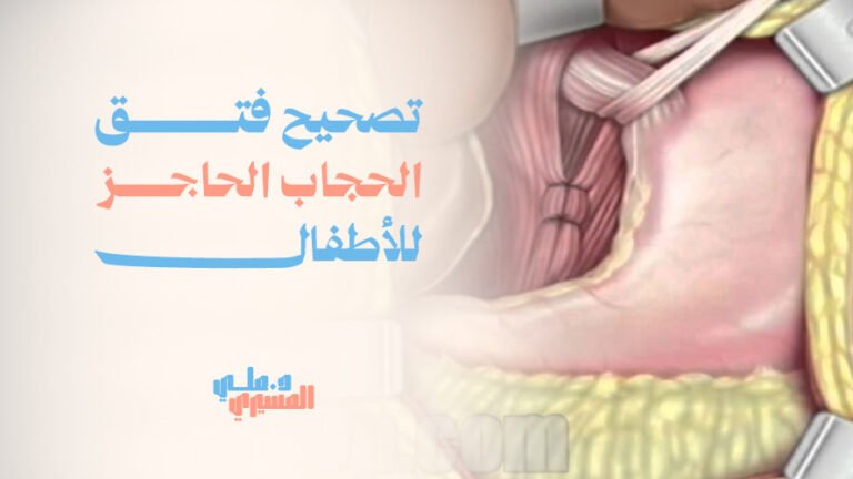 تصحيح فتق الحجاب الحاجز للأطفال