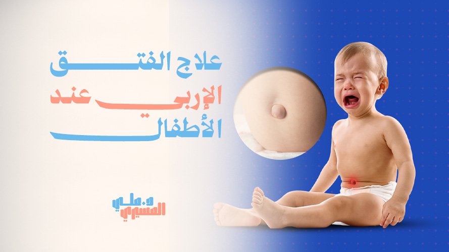 علاج الفتق الإربي عند الأطفال, بأحدث التقنيات الطبية