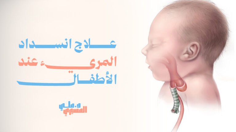 علاج انسداد المريء عند الأطفال