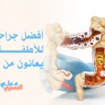 أفضل جراحة للأطفال الذين يعانون من القولون