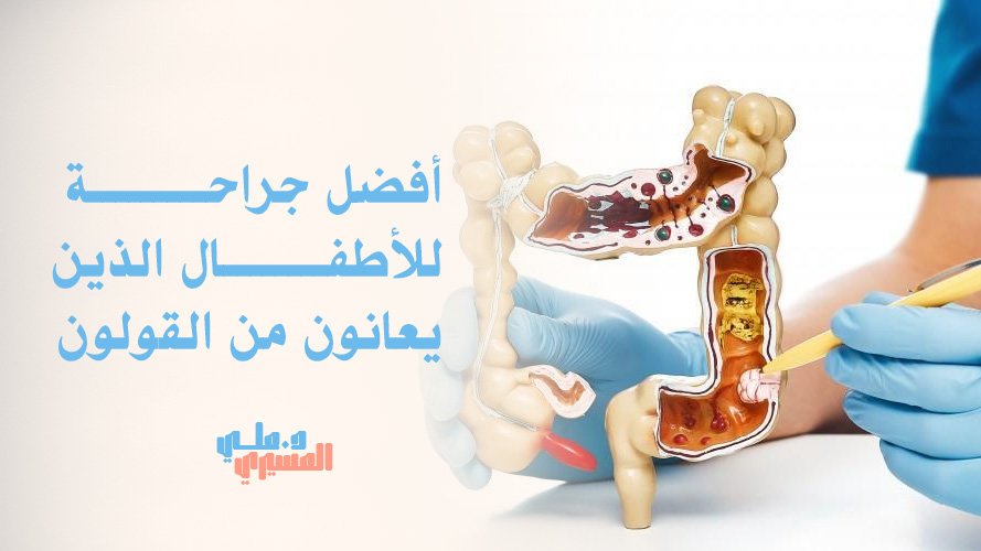 أفضل جراحة للأطفال الذين يعانون من القولون | علاج فعال وآمن