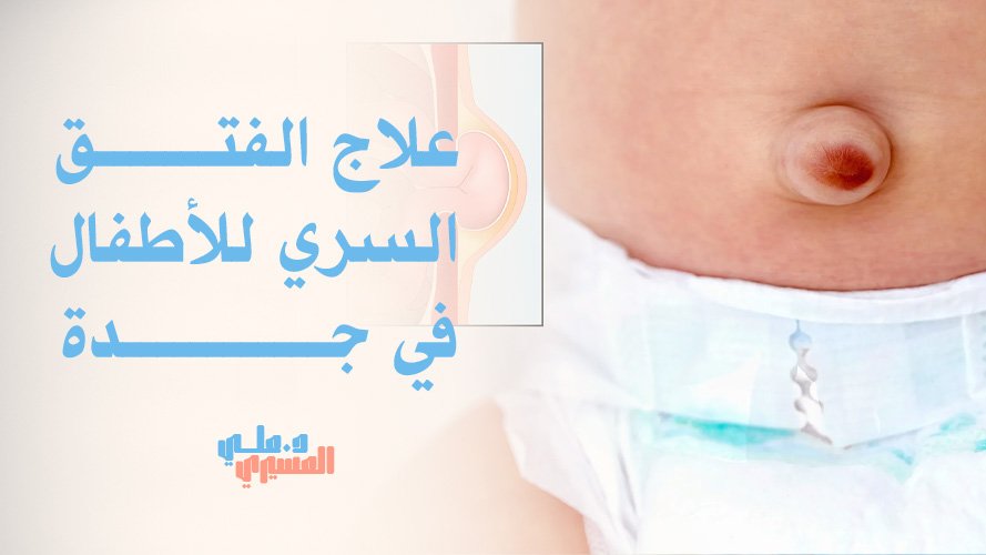 علاج الفتق السري للأطفال في جدة – استشارات جراحية آمنة وفعّالة
