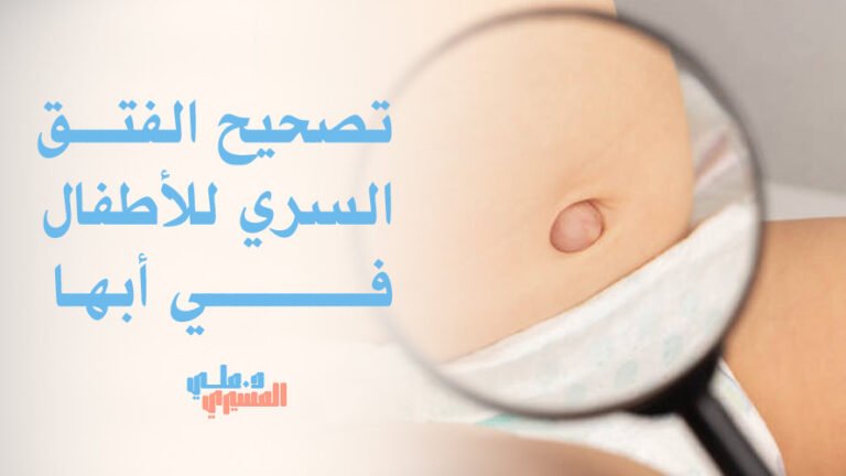 تصحيح الفتق السري للأطفال في أبها