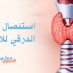 استئصال الكيس الدرقي للأطفال