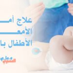علاج أمراض الأمعاء عند الأطفال بالجراحة