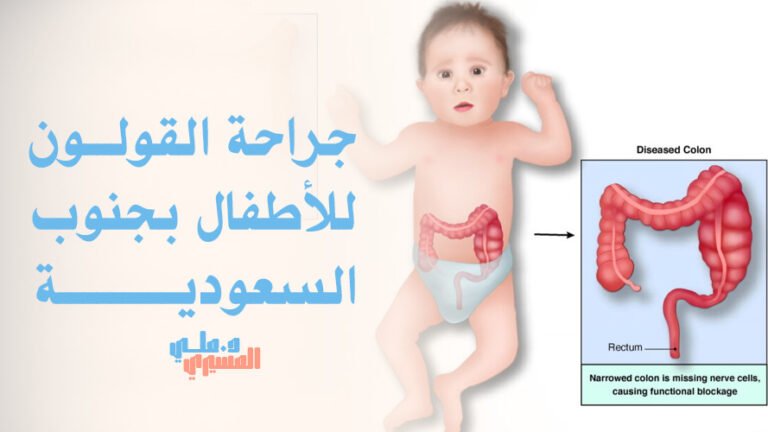جراحة القولون للأطفال بجنوب السعودية