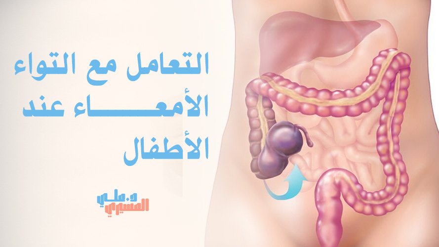 التعامل مع التواء الأمعاء عند الأطفال بسرعة | احجز الكشف