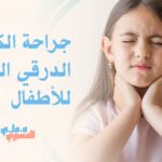 جراحة الكيس الدرقي اللساني للأطفال