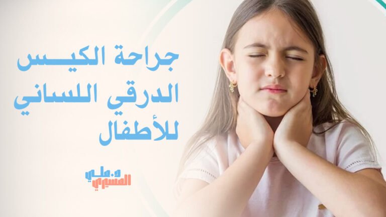 جراحة الكيس الدرقي اللساني للأطفال