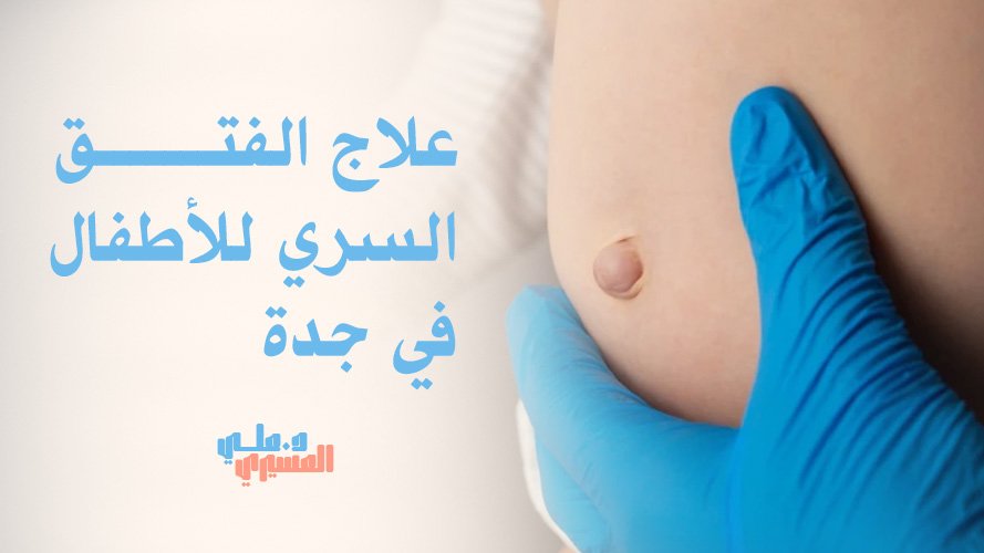 علاج الفتق السري للأطفال في جدة بخبرة جراحية دقيقة
