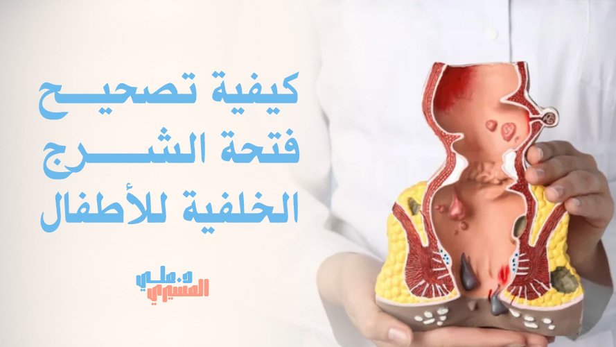 كيفية تصحيح فتحة الشرج الخلفية للأطفال مع جراح متخصص