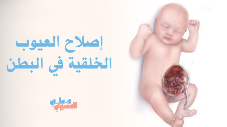 إصلاح العيوب الخلقية في البطن 