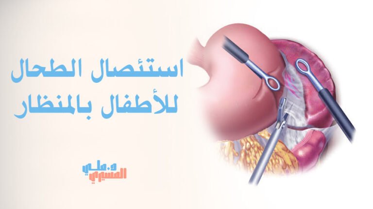 استئصال الطحال للأطفال بالمنظار