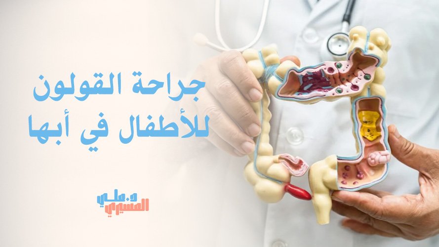 دليل جراحة القولون للأطفال في أبها والعيوب الخلقية