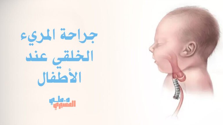 جراحة المريء الخلقي عند الأطفال