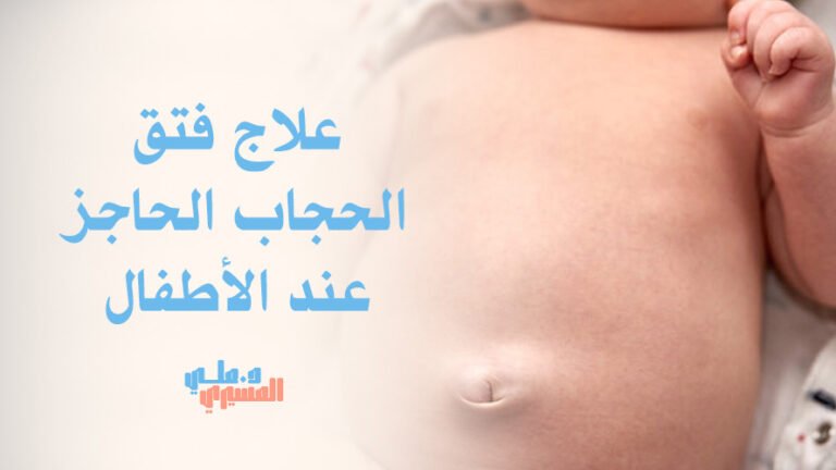 علاج فتق الحجاب الحاجز عند الأطفال