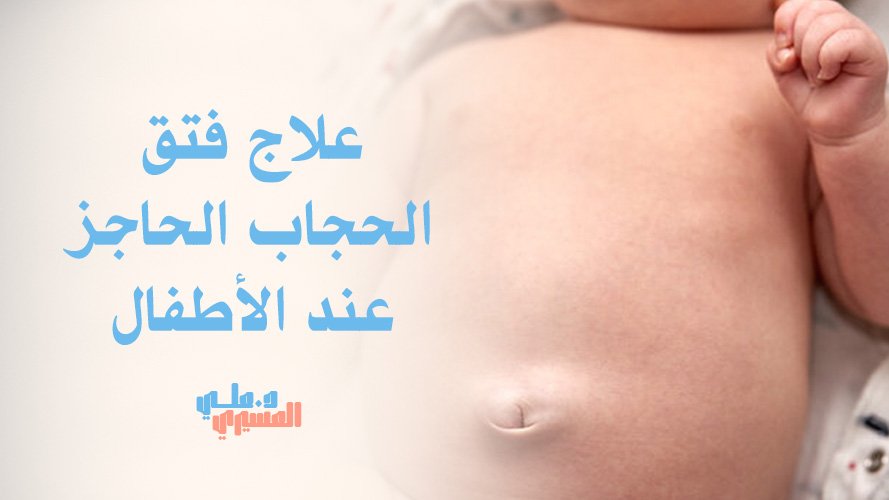 علاج فتق الحجاب الحاجز عند الأطفال بالمنظار