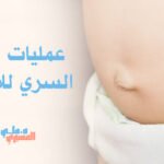 عمليات الفتق السري للأطفال