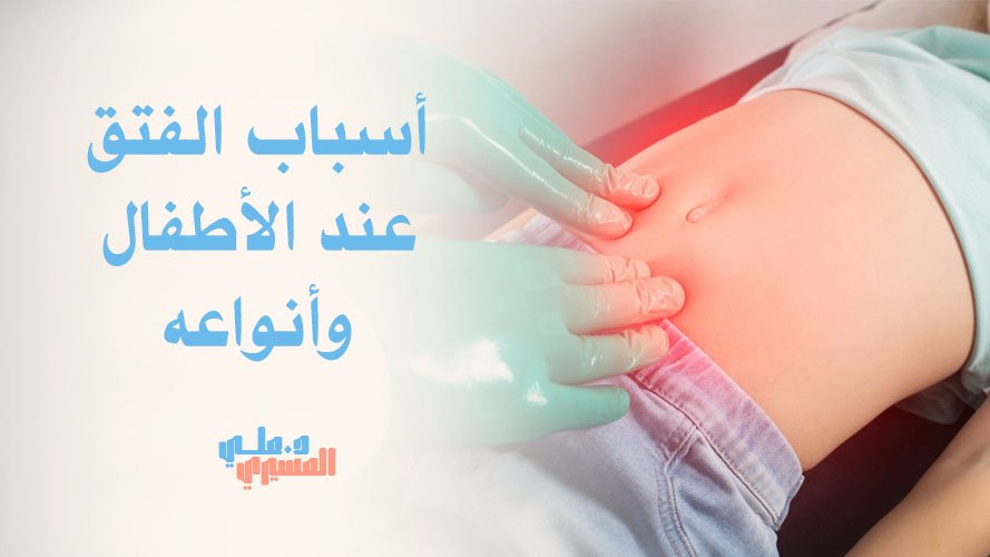 أسباب الفتق عند الأطفال وأنواعه | تعرف على الأعراض وطرق العلاج الفعالة