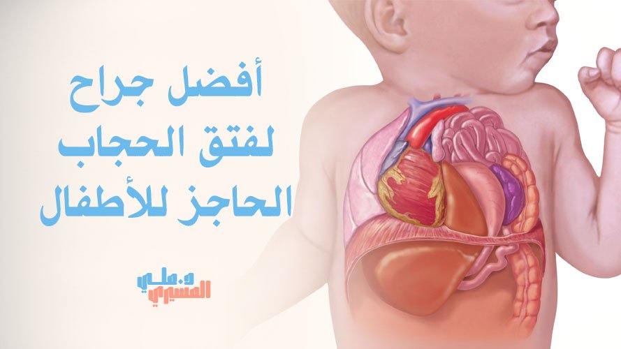 أفضل جراح لفتق الحجاب الحاجز للأطفال | احجز الاستشارة الآن بثقة