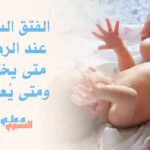 الفتق السري عند الرضع: متى يختفي ومتى يُعالج؟