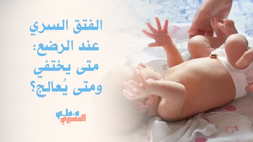 الفتق السري عند الرضع: متى يختفي ومتى يُعالج؟ | دليل الآباء الكامل