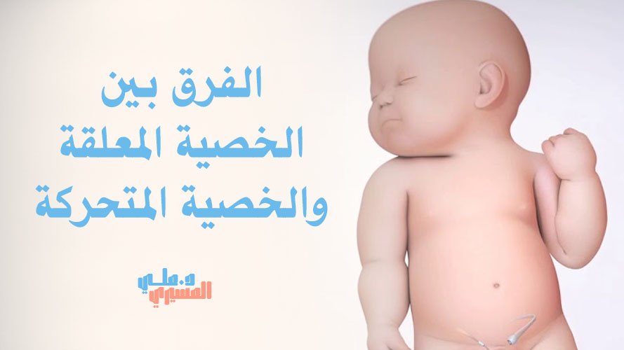 الفرق بين الخصية المعلقة والخصية المتحركة | التشخيص والعلاج
