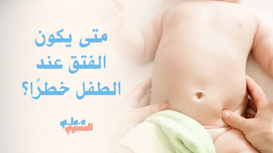 متى يكون الفتق عند الطفل خطرًا؟ | علامات تستوجب التدخل السريع
