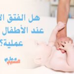 هل الفتق الإربي عند الأطفال يحتاج عملية؟