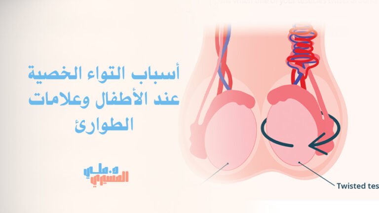 أسباب التواء الخصية عند الأطفال وعلامات الطوارئ