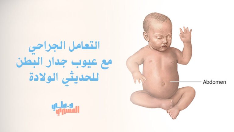 التعامل الجراحي مع عيوب جدار البطن للحديثي الولادة