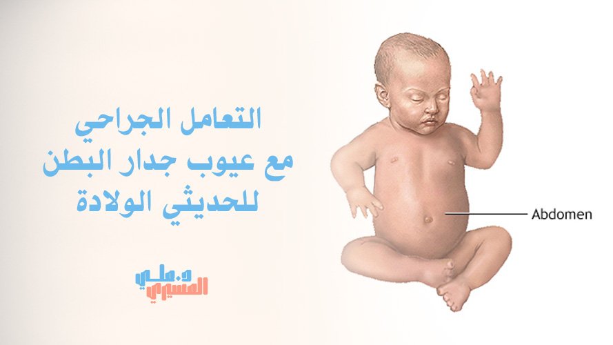 التعامل الجراحي مع عيوب جدار البطن للحديثي الولادة | احجز الآن