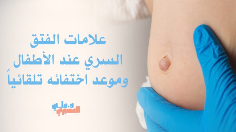 علامات الفتق السري عند الأطفال وموعد اختفائه تلقائياً